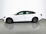 2022 Chevrolet Malibu RS